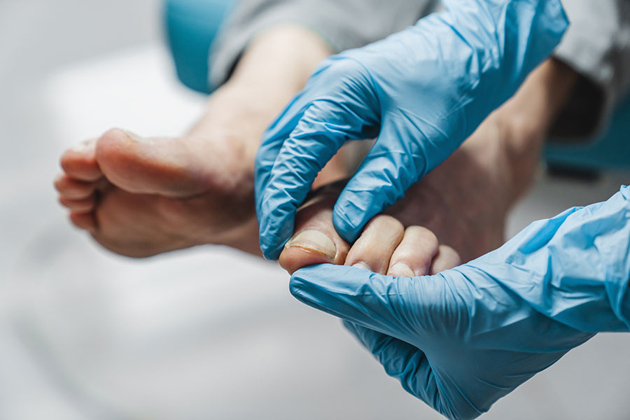 Manos de un podólogo tratando el dedo de un pie