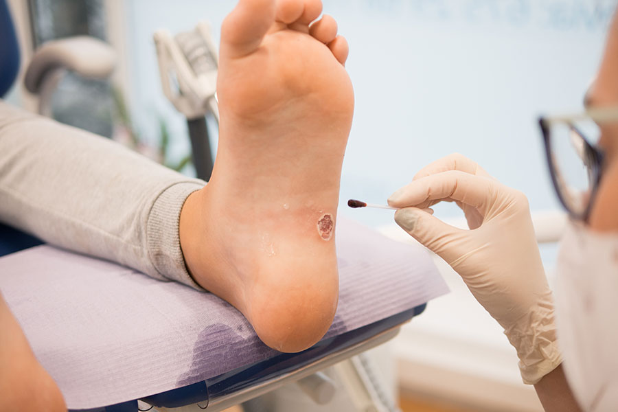 Podólogo curando una herida en la planta del pie
